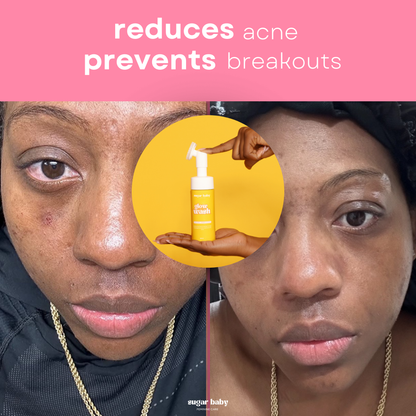 VIRAL Turmeric & Kojic Acid Wash