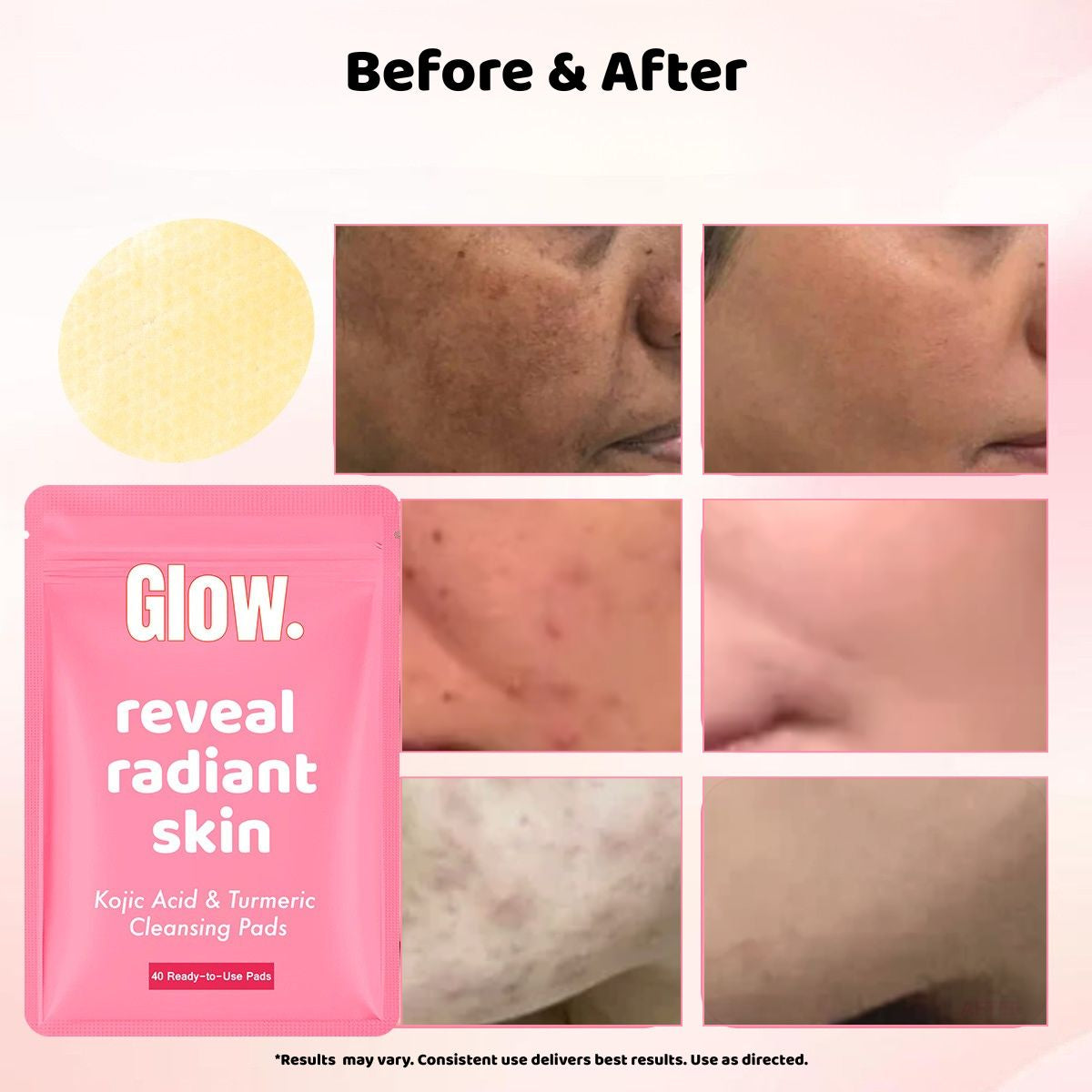 Kojic and Turmeric Pads